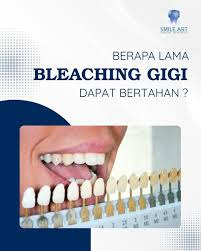 Pantangan Setelah Bleaching Gigi Agar Putihnya Tahan Lama