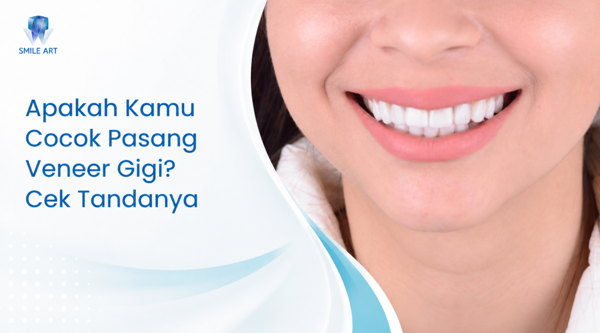 Apakah Kamu Cocok Pasang Veneer Gigi? Cek Tandanya