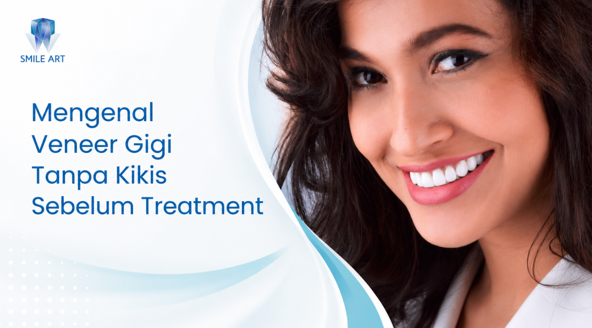 Mengenal Veneer Gigi Tanpa Kikis Sebelum Treatment