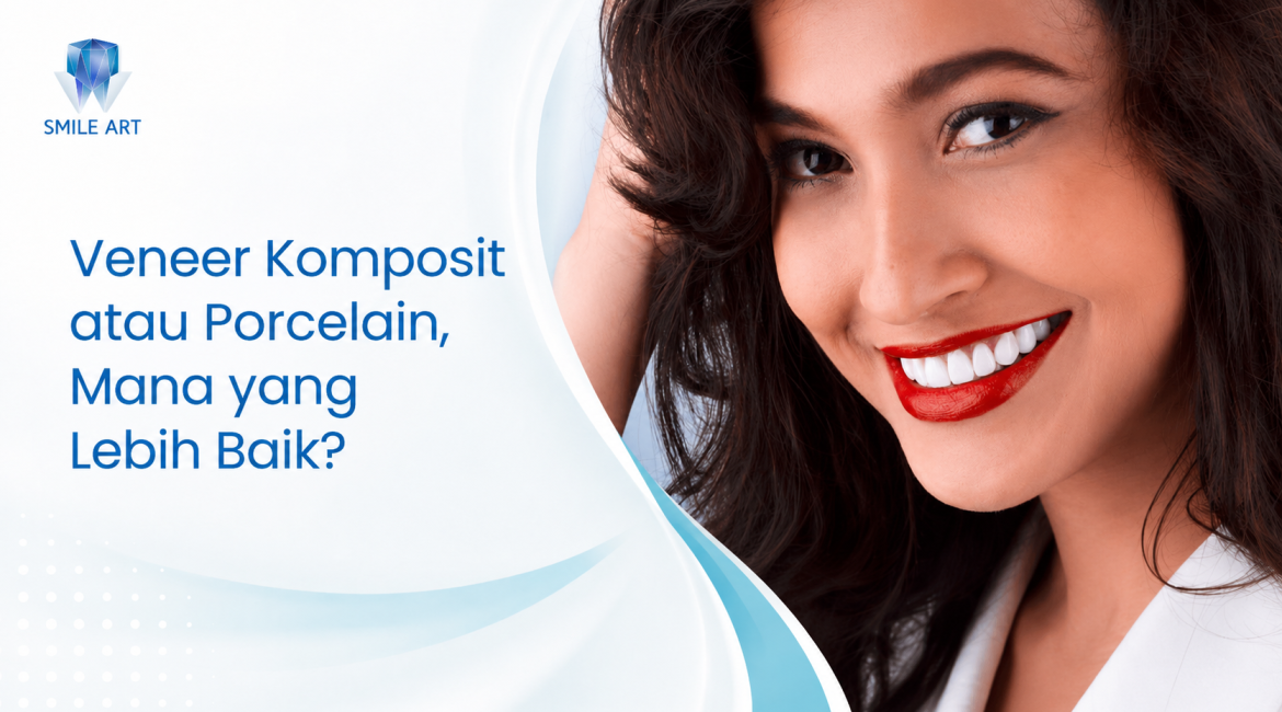 Veneer Komposit atau Porcelain, Mana yang Lebih Baik?
